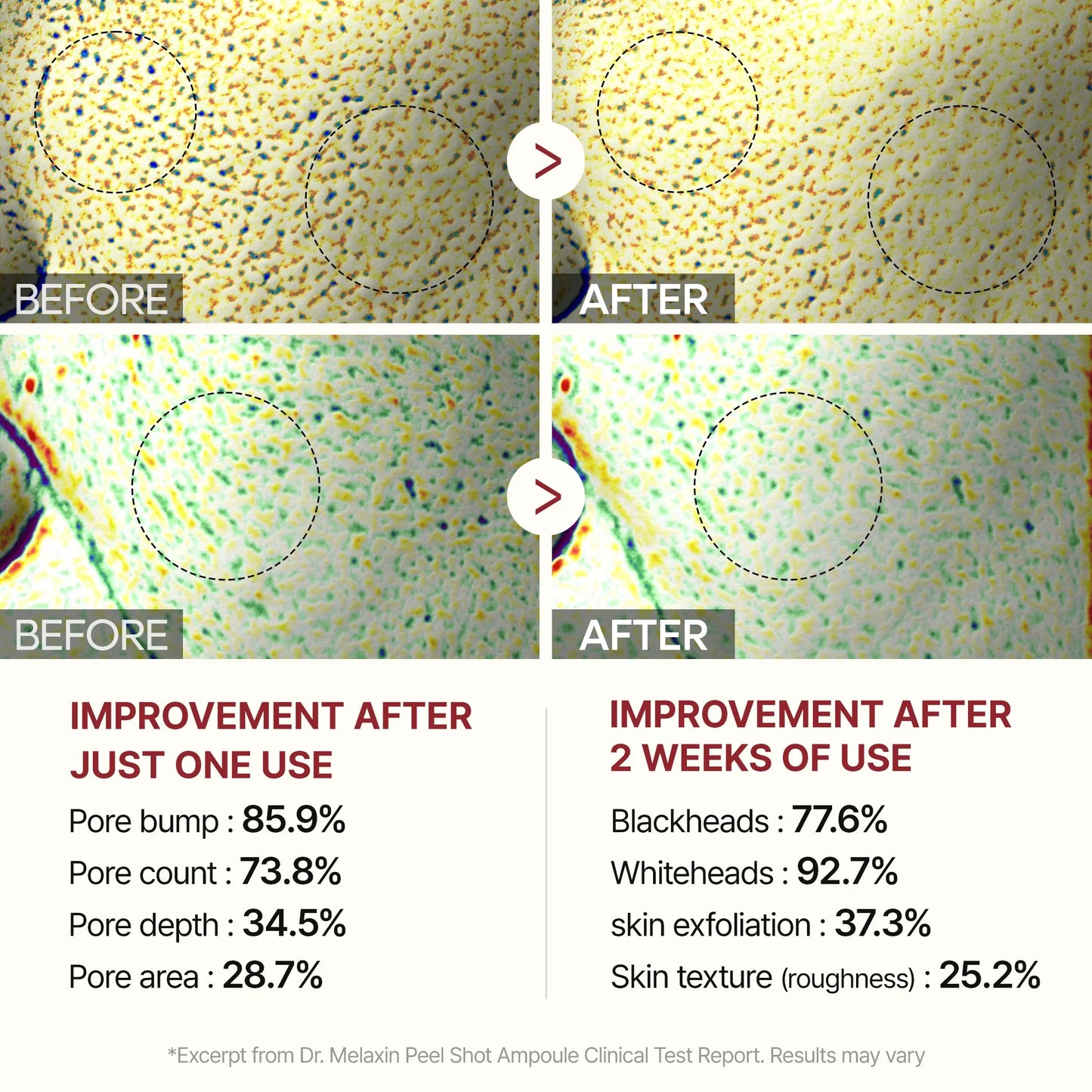 Peel Shot | Rice Peeling Glow Serum