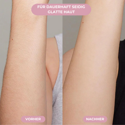 FLOAMMI - IPL Hair Removal